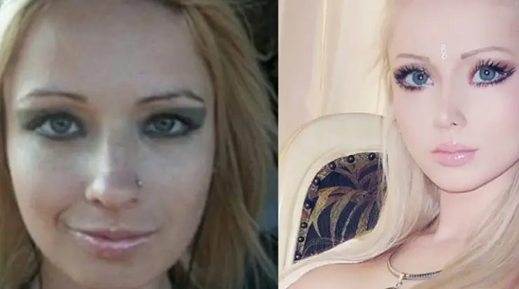 La jeune fille qui a créé le look de poupée : à quoi elle ressemblait avant