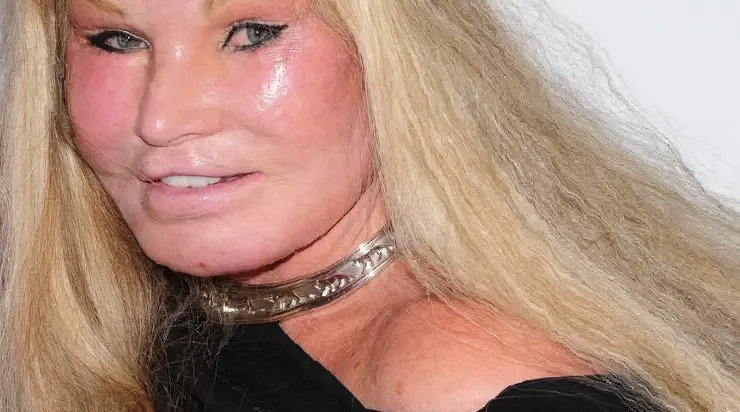 À quoi elle ressemblait avant les opérations esthétiques et pourquoi elle a changé son apparence