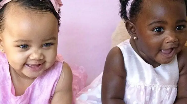 Les sœurs jumelles sont nées avec des couleurs de peau différentes, à seulement quelques minutes d’intervalle : découvrez à quoi elles ressemblent aujourd’hui.